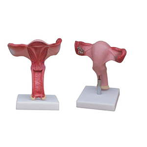 Magnified Uterus Model